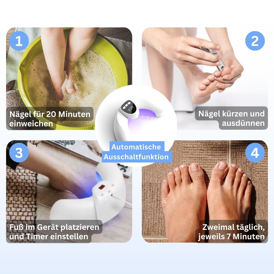 MykoCare - Innovative Lichtbehandlung gegen Nagelpilz